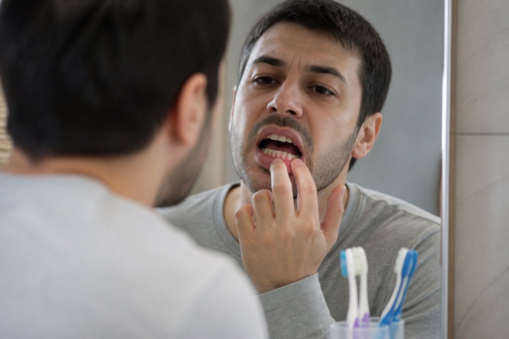 At Home Dental Care for Receding Gums: 2026 Guide